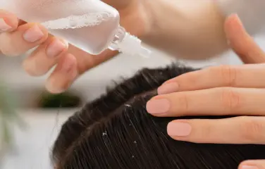 A woman in a hair care clinic with dandruff having her hair shampooed to get rid of the dandruff.
