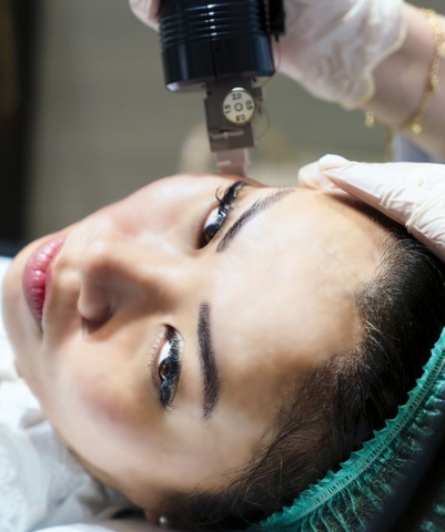 A qualified MNRF Acne Scar Removal Treatment specialist treating a patient's face in a medical facility