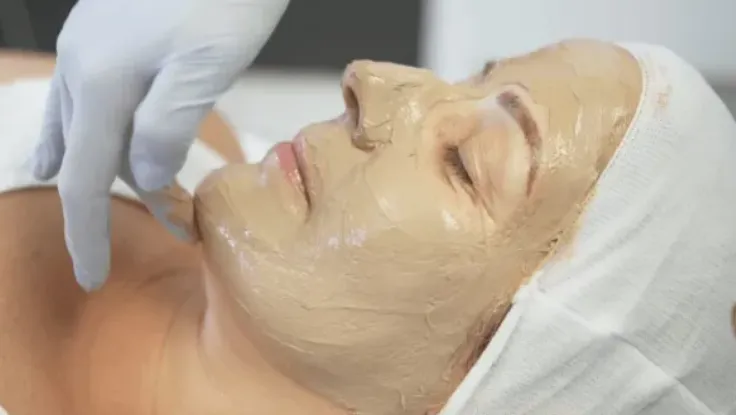 A woman had a facial mask applied during a cosmelan depigmentation skin treatment at a spa